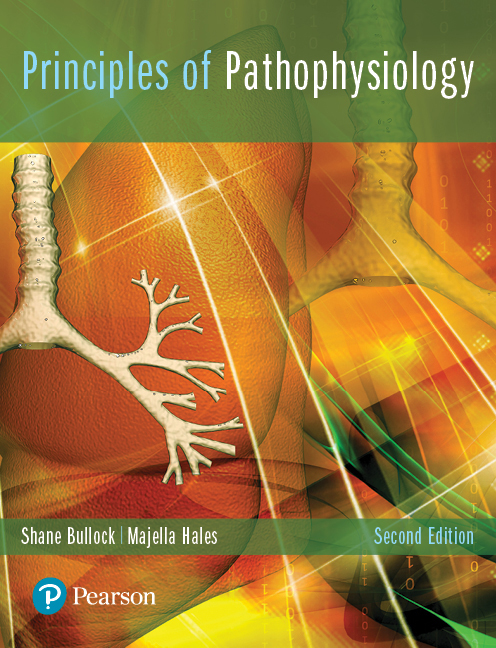 Principles of Pathophysiology, 2nd Edition